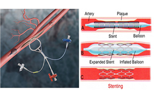 1515374604194503.jpg 04.jpg